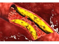 甘油三酯的克星就在身边，你若爱吃，高血脂不会找上门来
