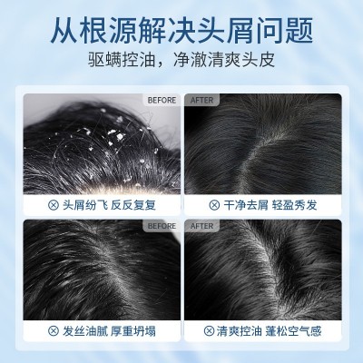二硫化硒毛囊洗发水去屑头皮驱螨控油蓬松去油洗发露洗头膏3瓶图4