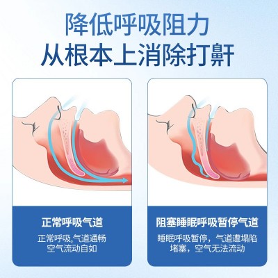 海德药业液体止鼾器厂家货源一手批发支持代加工打呼噜止鼾图2