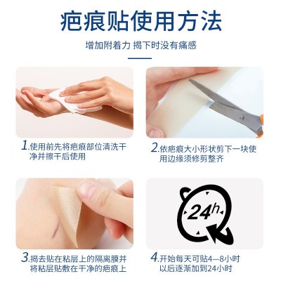 疤克硅凝胶疤痕贴剖腹产疤痕修护贴淡化疤痕贴烧伤烫伤术后疤痕贴图2