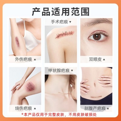 疤克硅凝胶疤痕贴剖腹产疤痕修护贴淡化疤痕贴烧伤烫伤术后疤痕贴图3