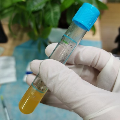 三力医用PRP采血管血清分离管 PRP提取试管美容管8ml抗凝剂分离胶图3