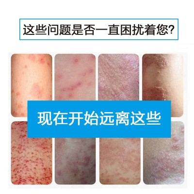 芦荟抑菌膏足部护理草本抑菌软膏消字号外用涂抹乳膏20g批发代发图3