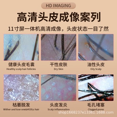 头皮检测仪器理发店头发皮肤脸部测试仪分析毛囊高清带屏幕一体机图3