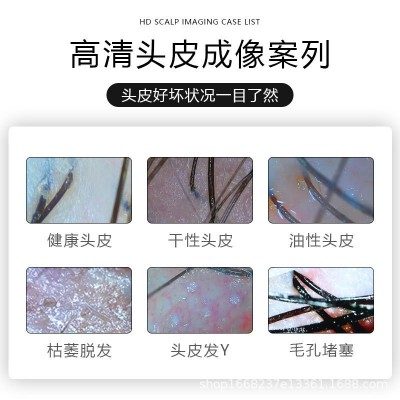 17寸头皮毛囊检测仪头发皮肤毛发测试理发店美容院高清带屏幕一体图2