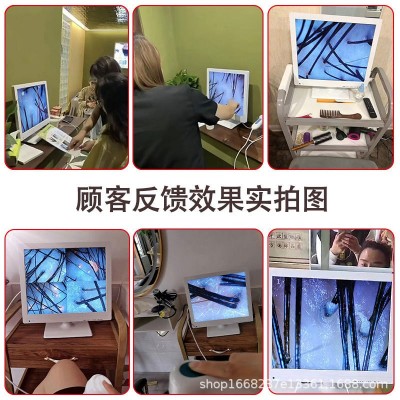 17寸头皮毛囊检测仪头发皮肤毛发测试理发店美容院高清带屏幕一体图3