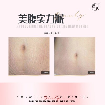 涅肤护肤品妈咪美腹霜 修护产后纹淡化肥胖纹 厂家批发一件代发图2