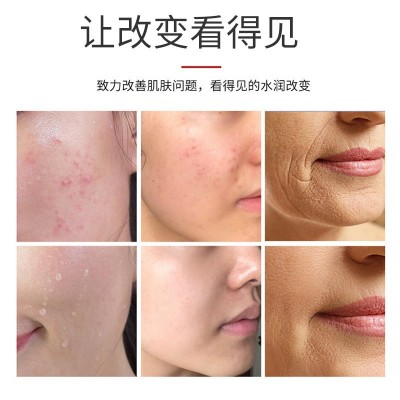 暨大基因鲜活外泌体脐带血外泌体悬液水光动能素全能水光精华批发图3