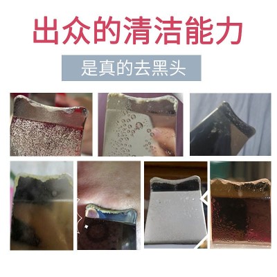 比森新款铲皮机 33K黑头铲离子导入导出面部按摩清洁超声 波铲皮机图2