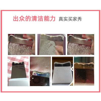 比森铲皮仪 去黑头铲面部清洁仪器 家用脸部美容导入超声波铲皮机图3