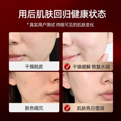 注氧仪美容仪器家用脸部补水精华导入仪美容院专用手持纳米喷雾枪图4