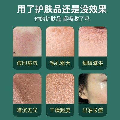 微针笔电动厂家直销微针仪器微晶导入仪飞梭仪跨境一件代发图2