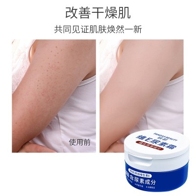 倾龄维E尿素霜补水保湿防冻防干裂润肤乳保湿身体乳厂家批发图3