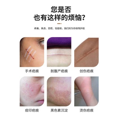 澳福来亮芙疤痕抑菌膏 祛巴痘印受伤疤痕凹凸伤痕草本修护 膏批发图3