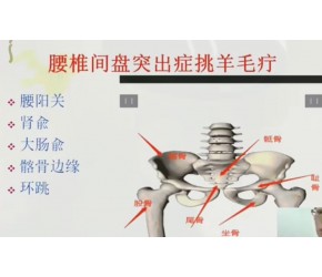记住这个方法，就能轻松缓解腰椎间盘突出！保健养生
