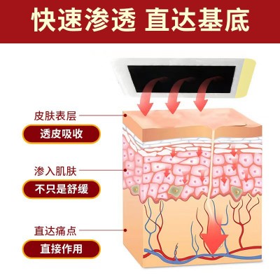 厂家批发膏药贴膝盖贴膝关节疼痛发热损伤膏药贴一件代发图4