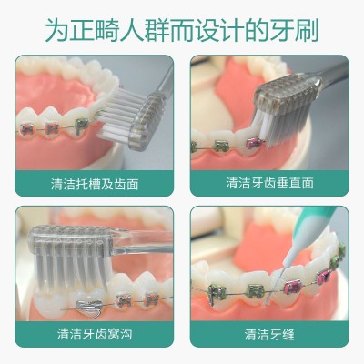正畸牙刷银离子小头矫正牙齿专用戴牙套清洁U形软毛箍牙缝 刷成人图4