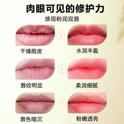 余伯年宝宝果油护唇膏儿童级保湿滋润润唇膏男女小孩秋冬防干裂膏图2
