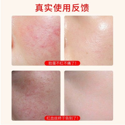 医妮美丽冷敷贴面膜补水保湿激光术后修护敏感肌院线贴片面 膜批发图4