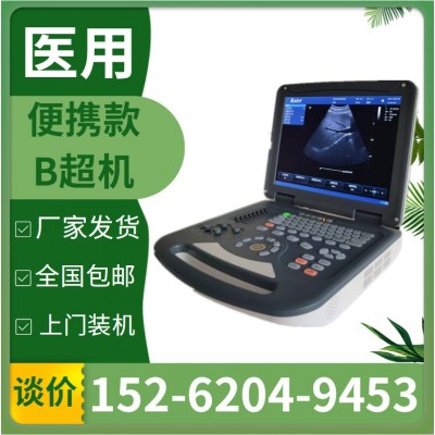 彩超机器彩超仪价格医疗设备彩色b超机 医院b超机 b超机 人用 厂图4