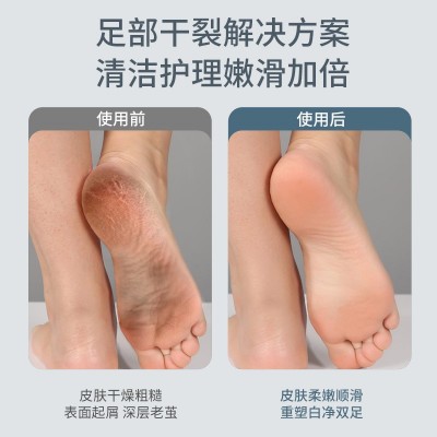 电动磨脚器修脚神器去脚皮老茧死皮全自动磨脚器修足机搓脚打磨机图4