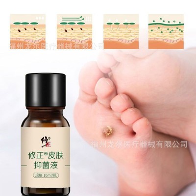 修正皮肤抑菌液清茧灵抑菌液手足老茧脖子肉粒草本护肤清茧子死皮图4