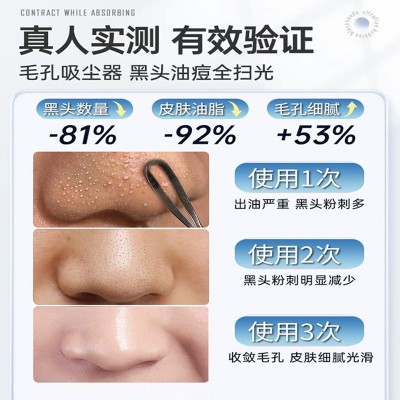 家用小气泡注氧仪面部吸黑头毛孔角质去粉刺洁面补水美白导入仪图2
