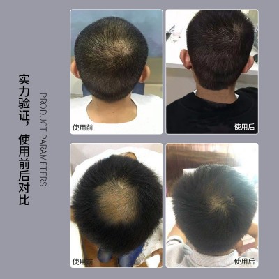 头皮理疗仪头疗头皮护理美容院头发按摩护养发毛囊检测头皮理疗仪图1