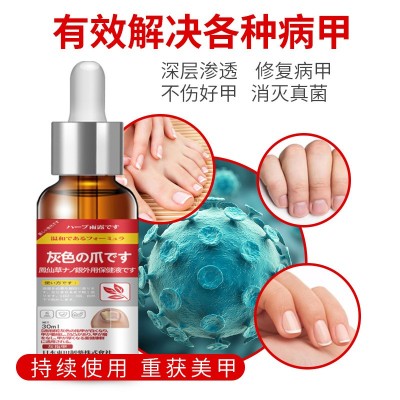 足部护理液增厚亮甲灰甲净软甲液甲变脆灰指甲凤仙草纳米 银液批发图4