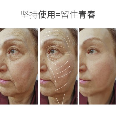 厂家直销黑金热玛吉淡化细纹提拉紧致美容护肤家用美容仪器热玛吉图2