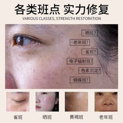 美容院臭臭水排铅汞斑黄褐斑祛黄褐斑去老年斑祛斑霜美白去黑色素图3