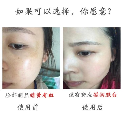 美容院美白祛斑霜美白去黑色素黄褐斑真皮斑祛斑套盒祛斑霜炸斑霜图2