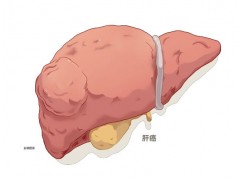 1个诱发肝癌的危险因素，很多年轻人中招！5件事尽早做