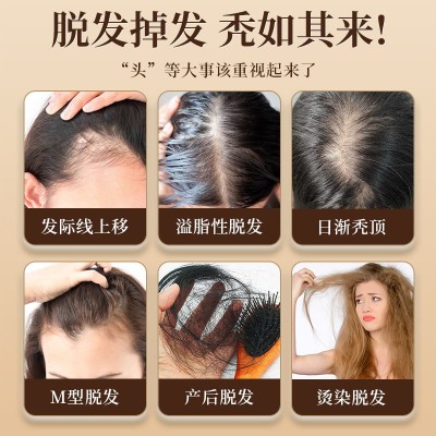 衡氏古方方脱育发液养发护发曾发精华液固发方脱喷雾厂家一件代发图2