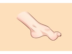 小儿麻痹的症状