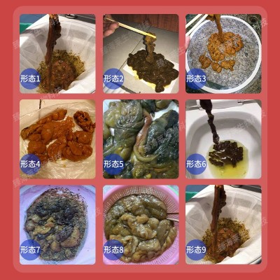 美容院用肝胆排净化套 综合果蔬酵素原液肝排肠排套盒厂家定制 1套图3