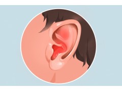 耳鸣是什么原因引起的