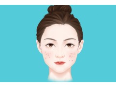 脸上长痘怎么调理