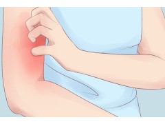 艾滋病身上会痒吗