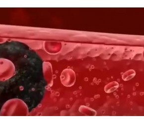 高血脂人群为了保持血管健康，避免堵塞，七个建议望采纳